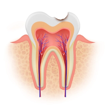 Illustration of a tooth