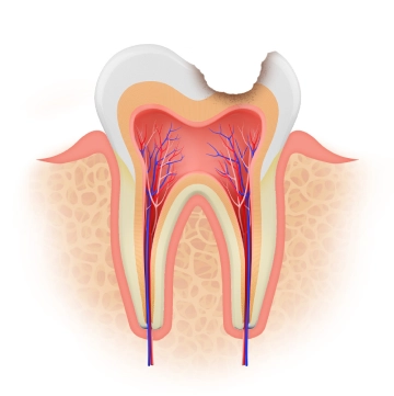 Illustration of a tooth