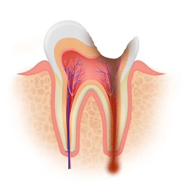 Illustration of a tooth